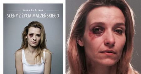 POBITA KORONIEWSKA w kampanii społecznej!