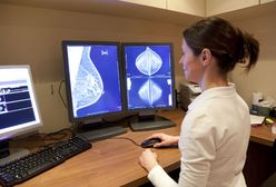 Kobiety bezpłatnie mogą skorzystać z konsultacji i mammografii w Katowicach