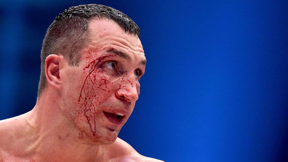 Getty Images / Na zdjęciu: Władimir Kliczko