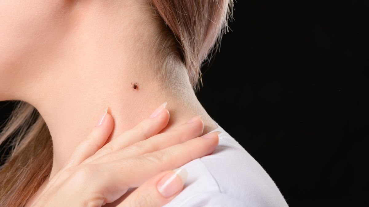 Kleszcz czy pieprzyk? Takie pytanie jest bardzo często zadawane przez pacjentów.