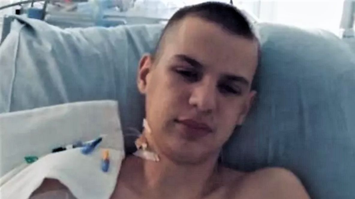 15-letni Filip z Niechobrza chciał zostać strażakiem. 