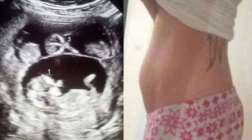 Shanice Sturdy, która została surogatką