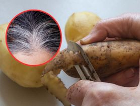 Tani i skuteczny sposób na siwe włosy. Potrzebujesz jedynie ziemniaków