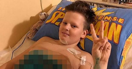 11-latek chciał nagrać wideo na YouTube. Stracił obie nogi