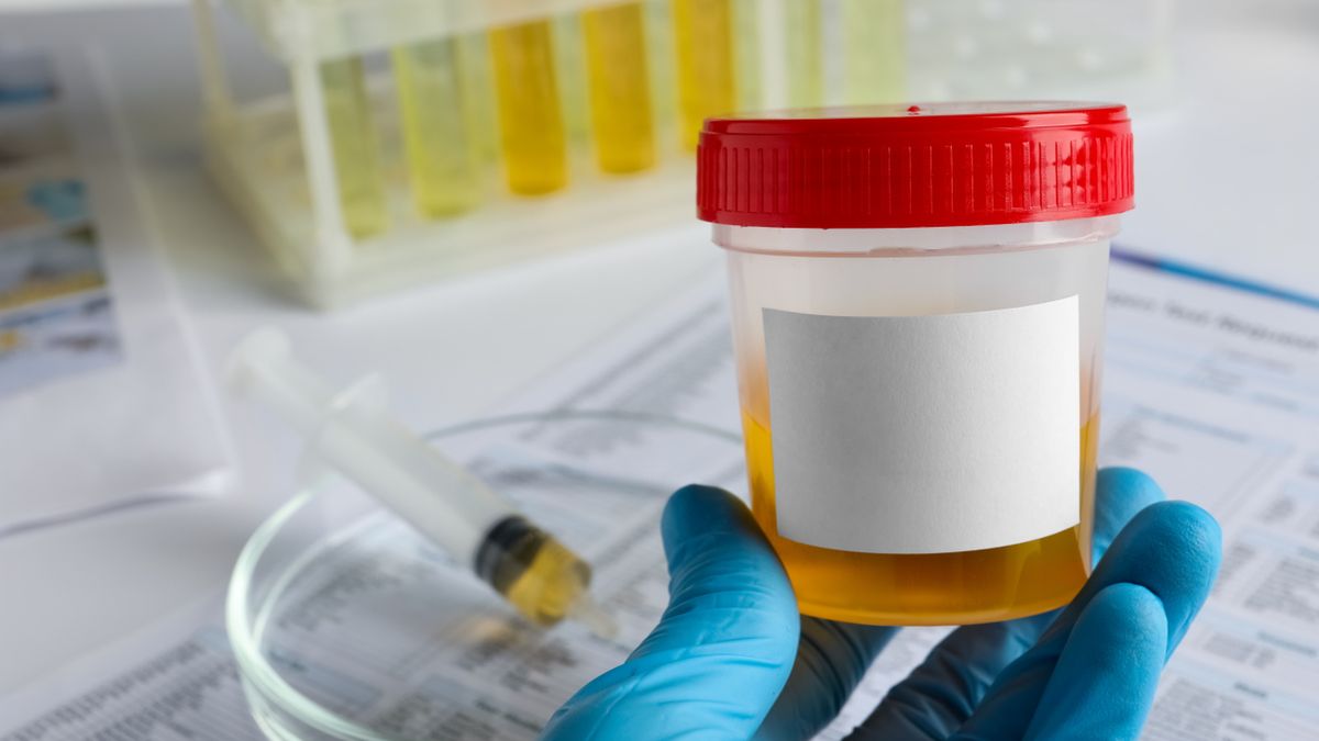 Nefropatia hipokaliemiczna może być spowodowana zaburzeniami w zagęszczeniu moczu