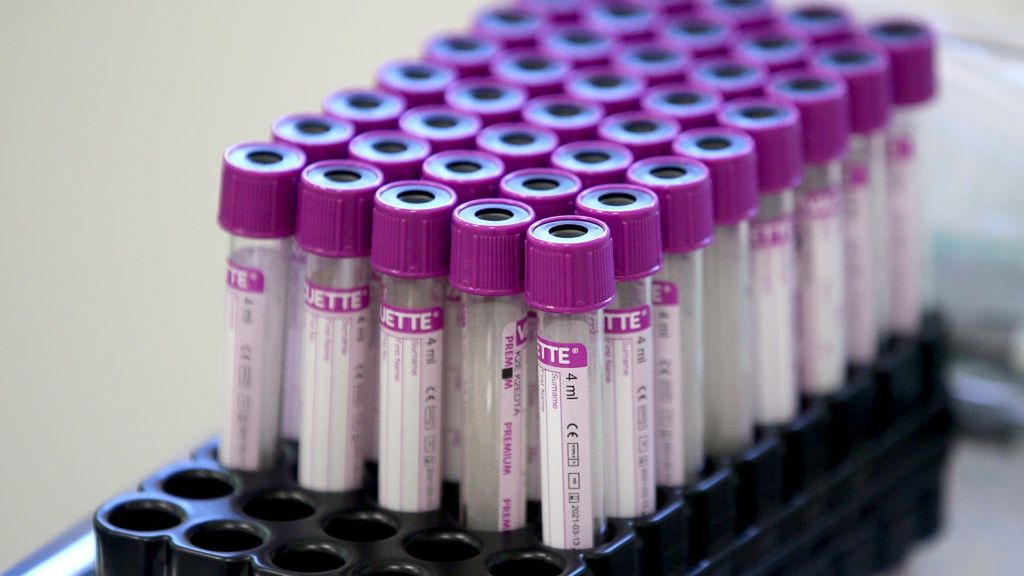 Koronawirus. Ekspert zabrał głos ws. testów