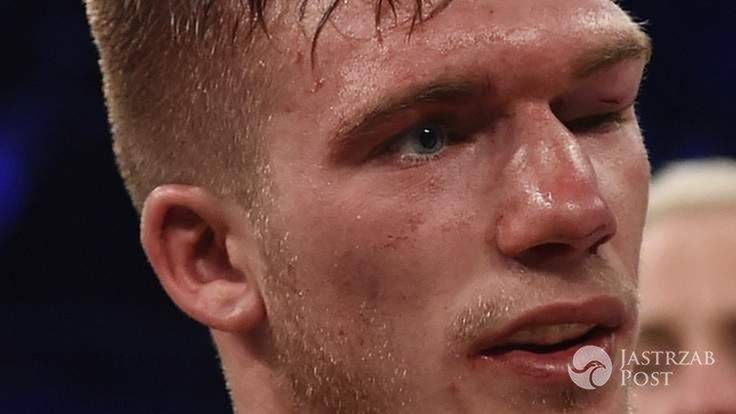 Brytyjski bokser wybudził się ze śpiączki fot. twitter.com
