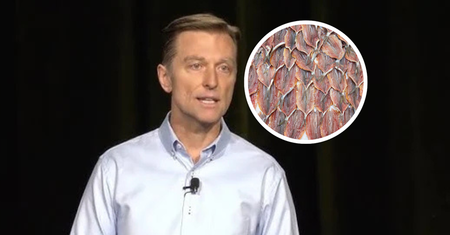 Czyszczą tętnice lepiej niż aspiryna. Jedz, by uniknąć udaru