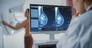 Zaproszenie na mammografię dla mieszkanek powiatu miechowskiego