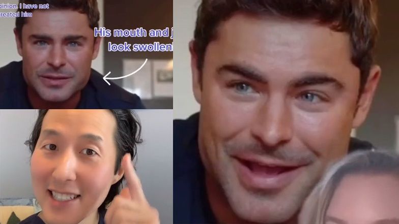 Chirurg plastyczny komentuje wygląd Zaca Efrona