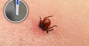Jak usunąć kleszcza? Pamiętaj o ważnej zasadzie