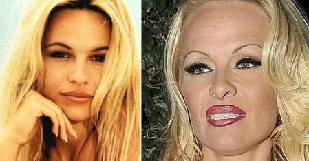 "Słoneczny patrol": Nowa twarz Pameli Anderson