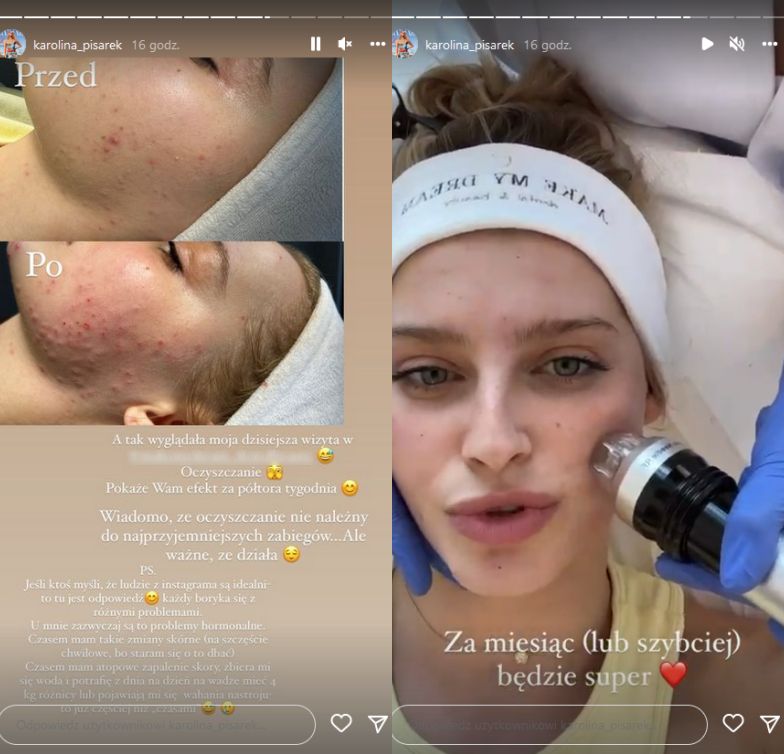 Karolina Pisarek relacjonuje wizytę u kosmetyczki