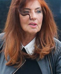 Agnieszka Fitkau-Perepeczko na żal do TVP. Wszystko opisała w sieci