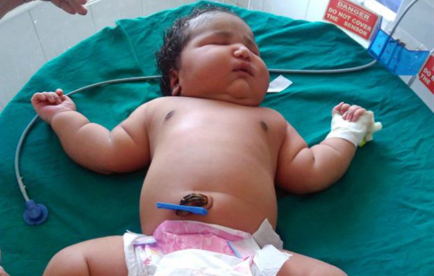 W Indiach urodziła się prawdopodobnie największa dziewczynka na świecie