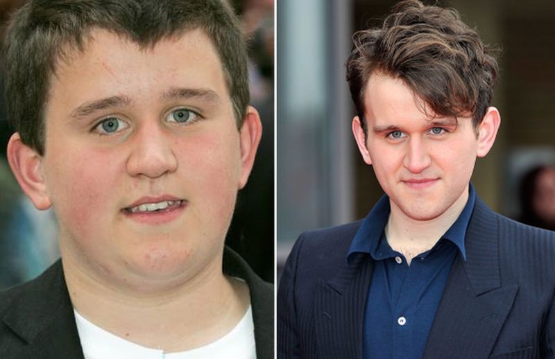 Harry Melling