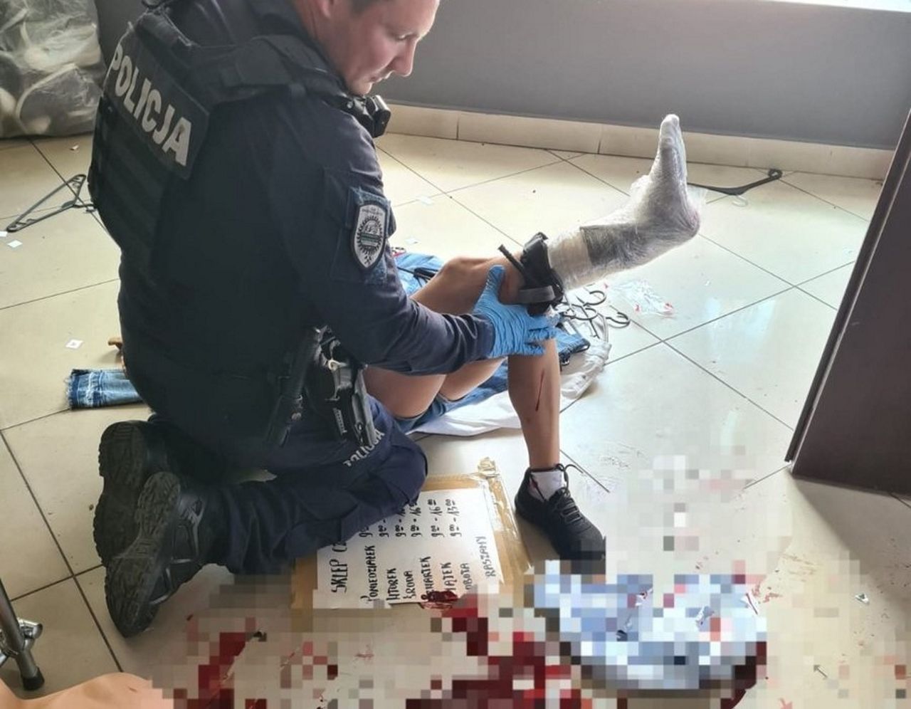 Dramat w sklepie w Świętochłowicach. Lustro rozcięło kobiecie nogę