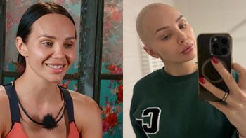 Uczestniczka "Farmy" ma nowotwór. Życie z chorobą relacjonuje na Instagramie: "Z łysą głową, bez makijażu, z opuchniętą twarzą..." (FOTO)