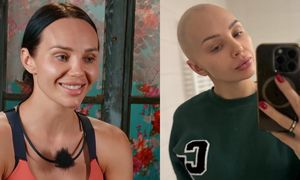 Uczestniczka "Farmy" ma nowotwór. Życie z chorobą relacjonuje na Instagramie: "Z łysą głową, bez makijażu, z opuchniętą twarzą..." (FOTO)