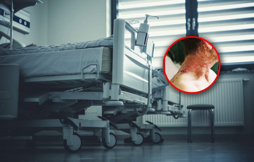 Zachoruje nawet co trzeci Polak. "To są naprawdę bardzo cierpiący ludzie"