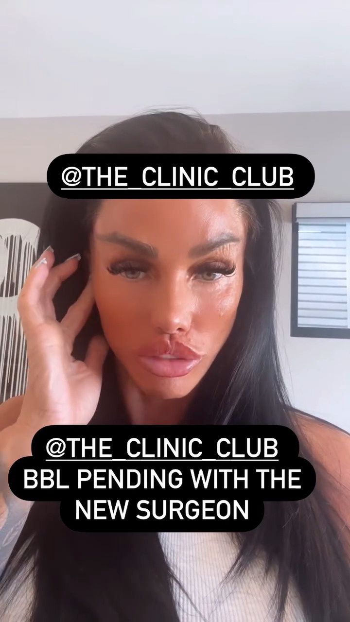 Katie Price opowiedziała o kolejnym zabiegu chirurgicznym