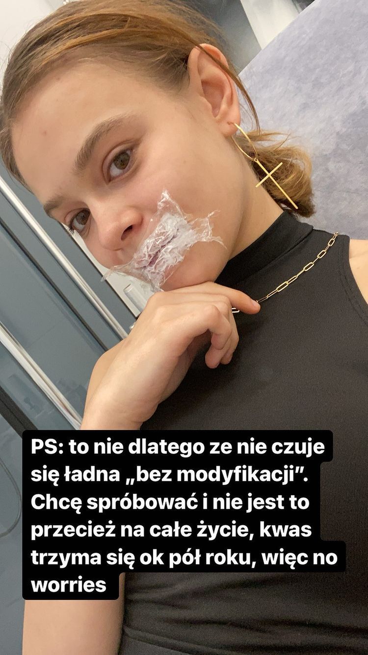 Julia Wróblewska powiększyła usta