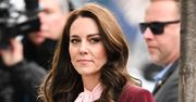 Kate Middleton korzystała z medycyny estetycznej? Tiktokerka wylicza ZABIEGI, którym miała poddać się księżna!