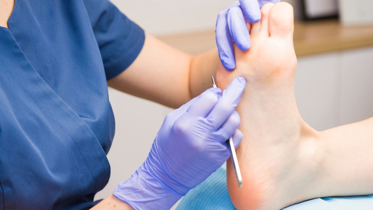 Pęcherze na stopach to zmiany, które mogą być bardzo dokuczliwe.