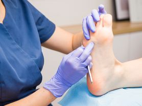 Pęcherze na stopach - leczenie i domowe sposoby, zapobieganie