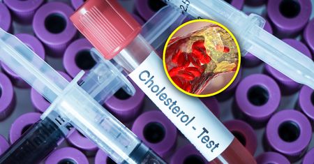 Jak najszybciej zbadaj cholesterol. Zawał serca u osób w coraz młodszym wieku