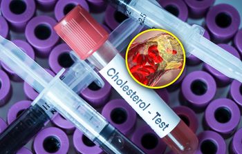 Jak najszybciej zbadaj cholesterol. Zawał serca u osób w coraz młodszym wieku