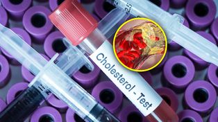 Jak najszybciej zbadaj cholesterol. Zawał serca u osób w coraz młodszym wieku