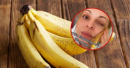 Pociera twarz skórką od banana. Ludzie łapią się za głowy
