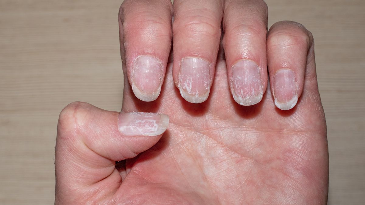 Jak zregenerować paznokcie po hybrydzie? 