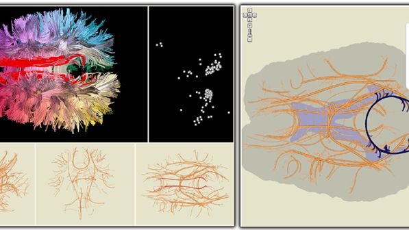 Mózg w Google Maps? 1