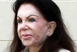 Jackie Stallone: Operacje plastyczne zdeformowały jej twarz
