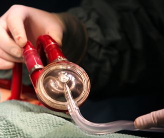 Proteza serca dla dzieci