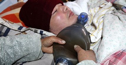 Fu Xuepeng od 7 lat żyje dzięki ręcznemu respiratorowi