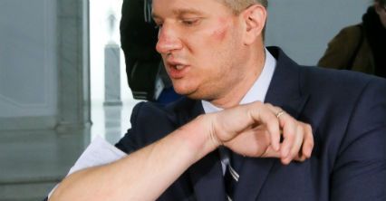 Przemysław Wipler: zostałem brutalnie pobity