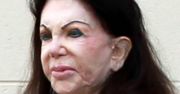 Jackie Stallone: Operacje plastyczne zdeformowały jej twarz