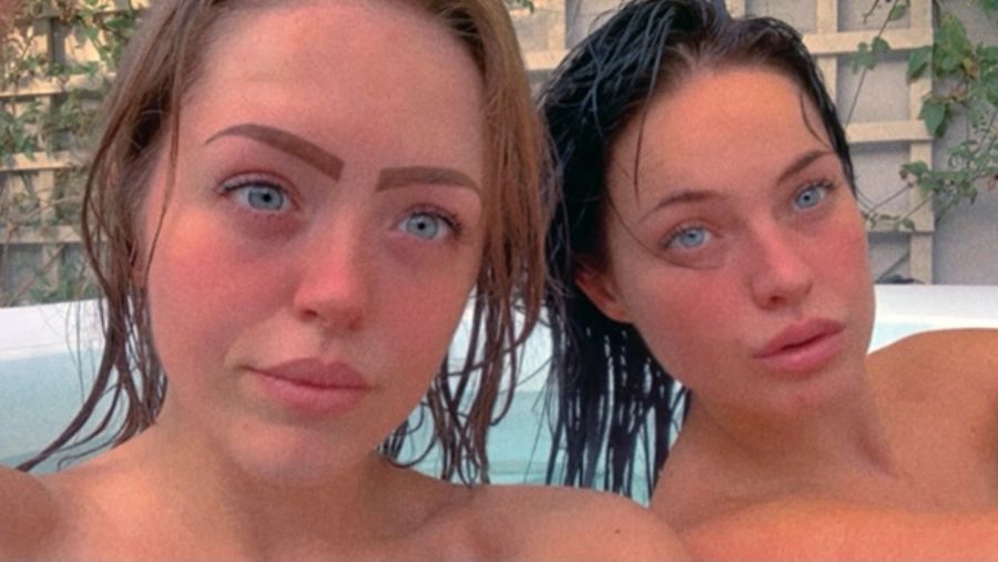 Matka nie poznała swojej córki. Dziewczyna straciła nogi w wyniku zakażenia po imprezie w jacuzzi