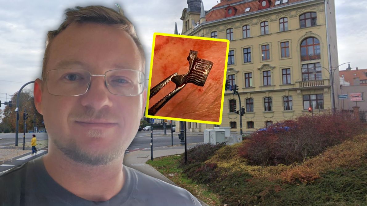 Po kilku dniach wyjęto mi z oka śrut