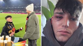 Oświadczył się partnerowi i został pobity. Są nowe doniesienia