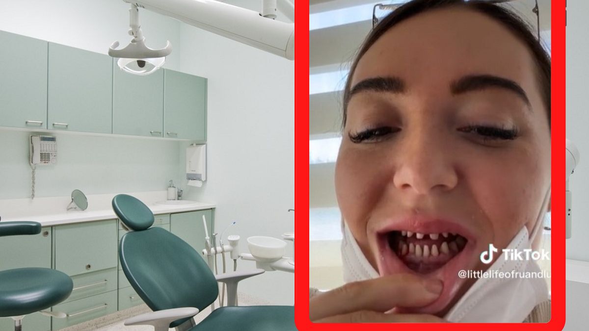 Zrobiła sobie tureckie zęby. 