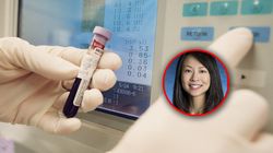 Tak "zdradza się" rak. Nowe badanie krwi pomoże wykryć nowotwór nawet trzy lata przed diagnozą