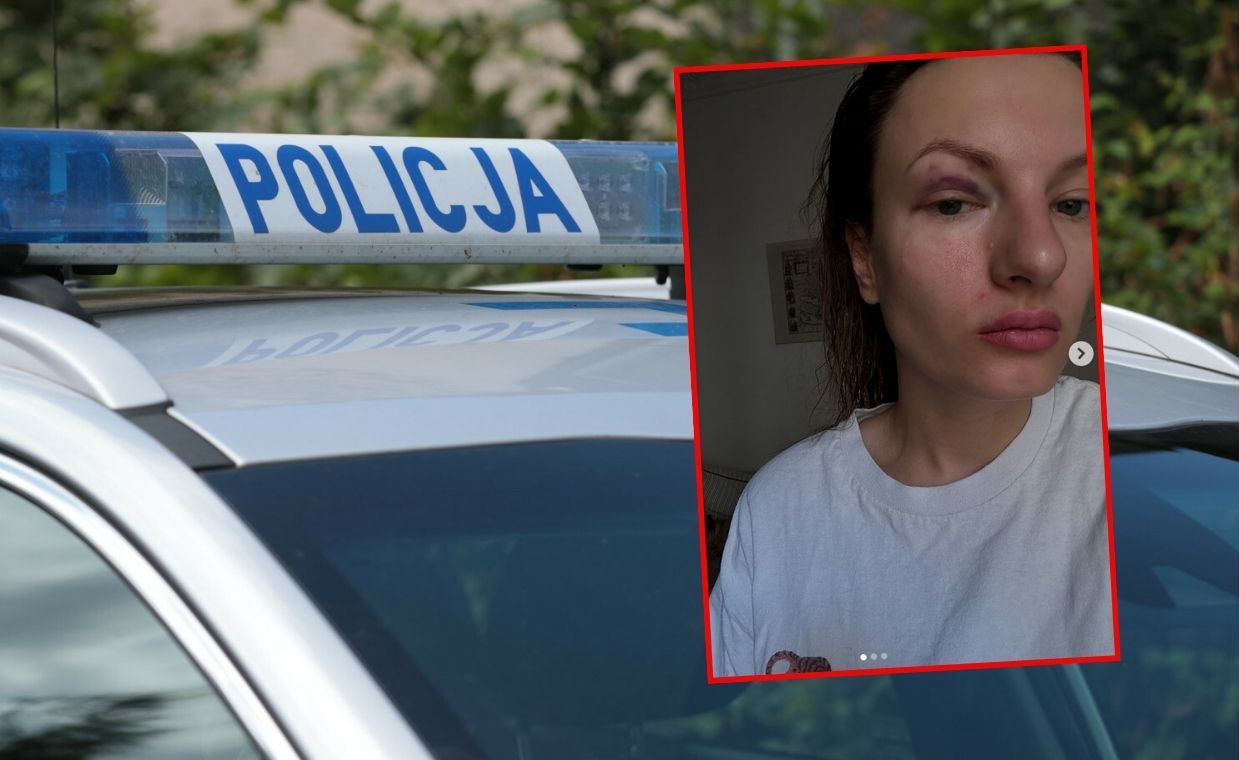 Zsiadł z roweru i pięścią uderzył kobietę. Brutalny atak w Warszawie