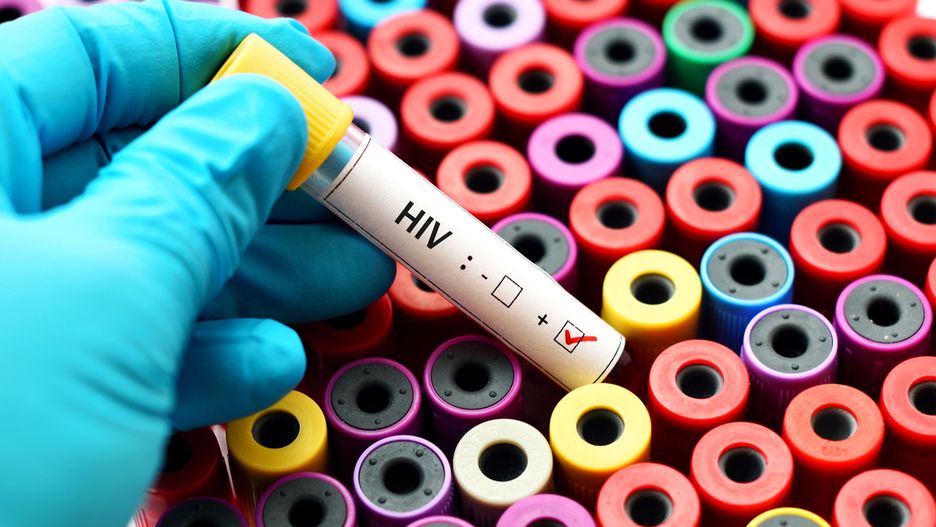 Wirus HIV: przyczyny, diagnostyka i leczenie