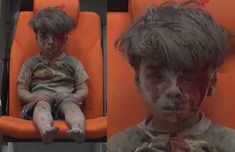 5-letni Syryjczyk uratowany z bombardowania był zbyt przerażony, by płakać (FOTO)