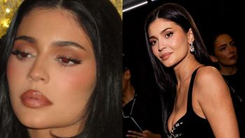 Kylie Jenner rozpuściła usta? "Wyglądają NORMALNIE" (FOTO)