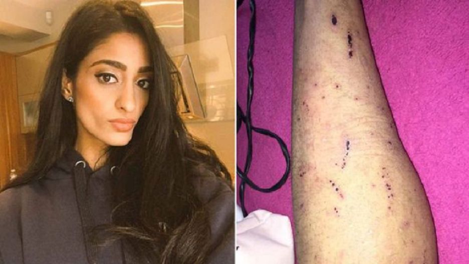 Lekarze pomyli raka ze świerzbem